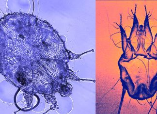 Scabies is evolving evading treatments involving Permethrin
