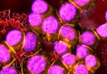 Link between autoimmunity to anti-desmoglein 2(DSG2) and the long-term sequelae of SARS-CoV-2 infection