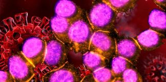 Link between autoimmunity to anti-desmoglein 2(DSG2) and the long-term sequelae of SARS-CoV-2 infection