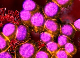 Link between autoimmunity to anti-desmoglein 2(DSG2) and the long-term sequelae of SARS-CoV-2 infection