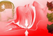 Obstructive Sleep Apnea causes premature cognitive decline
