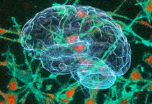 Neuropatologia: COVID-19 può comportare l’induzione della comparsa spontanea di prioni