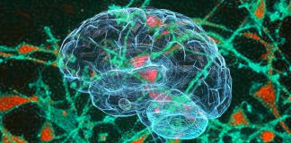 Neuropatologia: COVID-19 può comportare l’induzione della comparsa spontanea di prioni