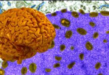 Neurological Manifestations, Types, Treatment and Outcomes of COVID-19-Associated Autoimmune Encephalitis