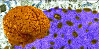 Neurological Manifestations, Types, Treatment and Outcomes of COVID-19-Associated Autoimmune Encephalitis