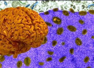 Neurological Manifestations, Types, Treatment and Outcomes of COVID-19-Associated Autoimmune Encephalitis