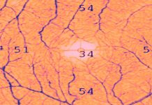 Evaluation of Retinal and Choroidal Microvasculature in SARS-CoV-2 Infection: A Review Based on Optical Coherence Tomography Angiography