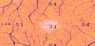 Evaluation of Retinal and Choroidal Microvasculature in SARS-CoV-2 Infection: A Review Based on Optical Coherence Tomography Angiography