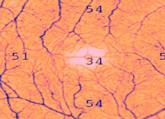 Evaluation of Retinal and Choroidal Microvasculature in SARS-CoV-2 Infection: A Review Based on Optical Coherence Tomography Angiography