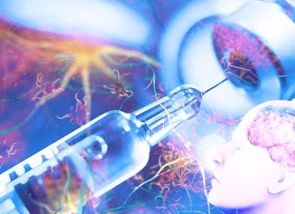 Il farmaco Donanemab rallenta significativamente il declino cognitivo e funzionale nelle persone con malattia di Alzheimer sintomatica precoce