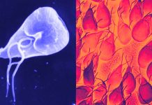 Protozoan Pathogens – Giardia duodenalis and dysentery in Iron Age Jerusalem