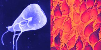 Protozoan Pathogens – Giardia duodenalis and dysentery in Iron Age Jerusalem