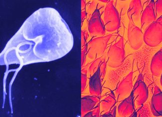 Protozoan Pathogens – Giardia duodenalis and dysentery in Iron Age Jerusalem