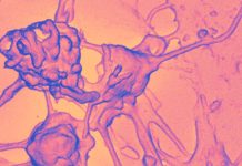IL-6 is produced in response to the detection of pathogen-associated molecular patterns (PAMPs) contained in allergens