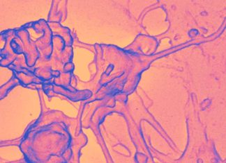 IL-6 is produced in response to the detection of pathogen-associated molecular patterns (PAMPs) contained in allergens