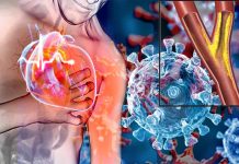 The Relationship Between COVID-19 and Coronary Heart Disease