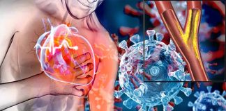 The Relationship Between COVID-19 and Coronary Heart Disease