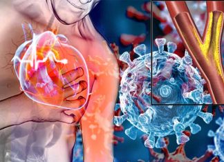 The Relationship Between COVID-19 and Coronary Heart Disease