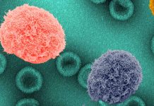 Breakthrough Study Reveals Insights into Stem Cell Transplant as Potential HIV Cure