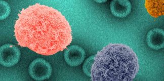 Breakthrough Study Reveals Insights into Stem Cell Transplant as Potential HIV Cure