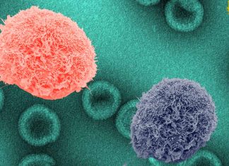 Breakthrough Study Reveals Insights into Stem Cell Transplant as Potential HIV Cure