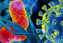 Is ventilator-associated pneumonia (VAP) linked to high mortality in severe COVID-19?