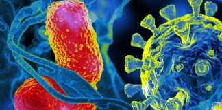 Is ventilator-associated pneumonia (VAP) linked to high mortality in severe COVID-19?
