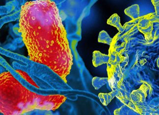 Is ventilator-associated pneumonia (VAP) linked to high mortality in severe COVID-19?