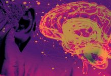 Disordered Auditory Processing as a Potential Biomarker for Alzheimer’s Disease Diagnosis