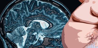 How obesity affects the brain’s ability to sense and respond to nutrients in the stomach and blood