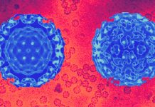 The Interplay Between Hepatitis B Virus (HBV) and SARS-CoV-2: Implications for Coinfection and Disease Management