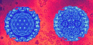 The Interplay Between Hepatitis B Virus (HBV) and SARS-CoV-2: Implications for Coinfection and Disease Management