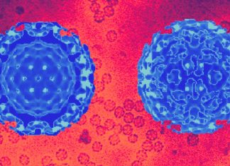 The Interplay Between Hepatitis B Virus (HBV) and SARS-CoV-2: Implications for Coinfection and Disease Management