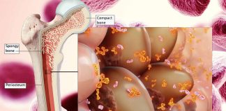 Overcoming Drug Resistance in Multiple Myeloma: Targeting Bone Marrow with Nanoparticle-Mediated siRNA Delivery