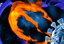 Cardiac MRI Findings in Patients with Post-Acute Sequelae of SARS-CoV-2 Infection: Insights from a Clinical Referral Cohort