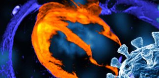 Cardiac MRI Findings in Patients with Post-Acute Sequelae of SARS-CoV-2 Infection: Insights from a Clinical Referral Cohort