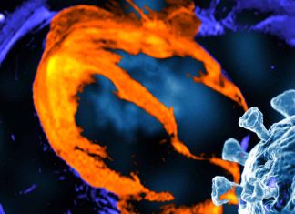 Cardiac MRI Findings in Patients with Post-Acute Sequelae of SARS-CoV-2 Infection: Insights from a Clinical Referral Cohort