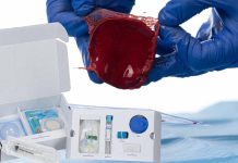 ActiGraft Pro: Revolutionary Wound Care Management System