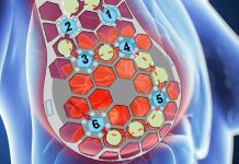 Advancing Cancer Detection with Conformable Ultrasound Breast Imaging: The Breakthrough cUSBr-Patch Technology