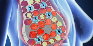 Advancing Cancer Detection with Conformable Ultrasound Breast Imaging: The Breakthrough cUSBr-Patch Technology