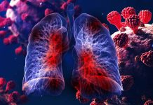 Understanding the Role of EC-like Myofibroblasts in COVID-19-Related Pulmonary Fibrosis