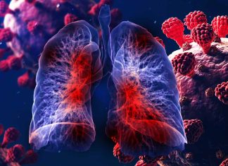 Understanding the Role of EC-like Myofibroblasts in COVID-19-Related Pulmonary Fibrosis