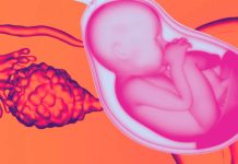 Cancer and Fertility Preservation: Pioneering Cell-Based Therapies for Restoring Ovarian Function and Fertility