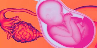 Cancer and Fertility Preservation: Pioneering Cell-Based Therapies for Restoring Ovarian Function and Fertility