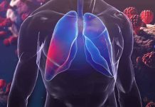 Quantitative CT Analysis Reveals Subtle Lung Volume Reduction in Long COVID Patients