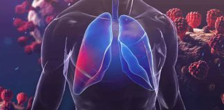 Quantitative CT Analysis Reveals Subtle Lung Volume Reduction in Long COVID Patients