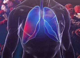 Quantitative CT Analysis Reveals Subtle Lung Volume Reduction in Long COVID Patients