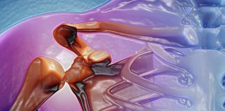 Understanding Musculoskeletal Disorders as Major Long-Term Effects of COVID-19