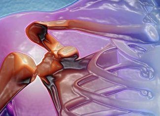 Understanding Musculoskeletal Disorders as Major Long-Term Effects of COVID-19