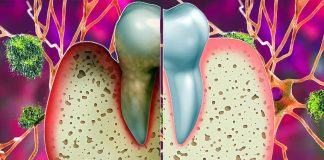 The Impact of Tooth Loss and Periodontitis on Hippocampal Atrophy: A Longitudinal Study in Late Middle-Aged and Older Adults